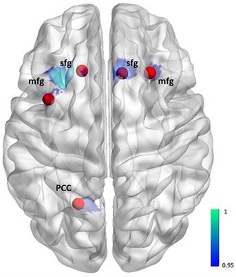 Increased Default Mode Network Connectivity in Obsessive–Compulsive Disorder During Reward Processing